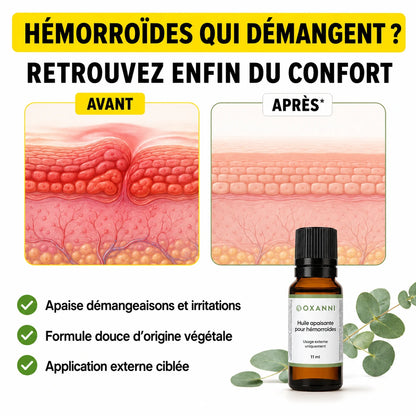 Huile Apaisante pour Hémorroïdes